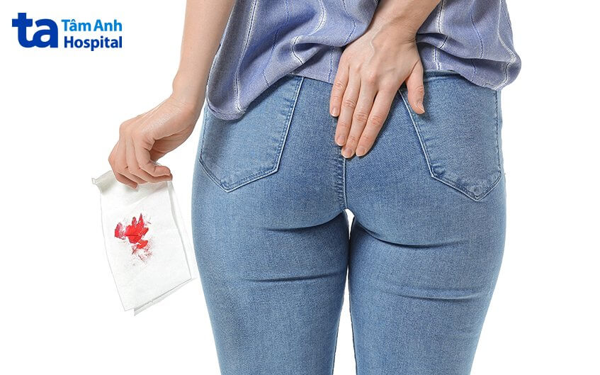 dấu hiệu tắc mạch trĩ