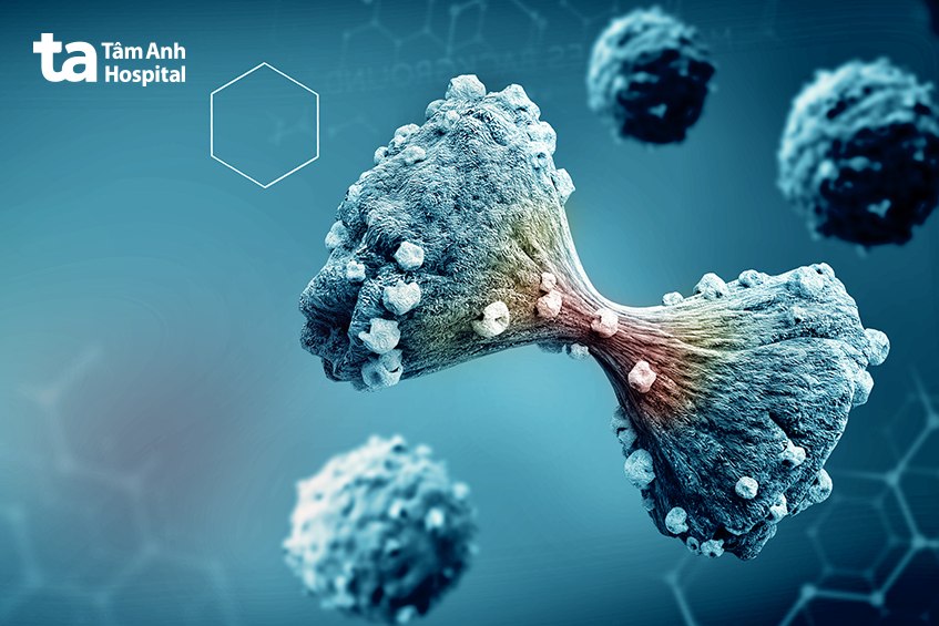 di căn ung thư vú mbc