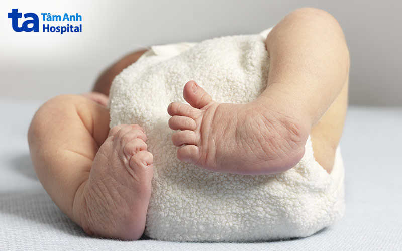 Dị tật bàn chân ở trẻ