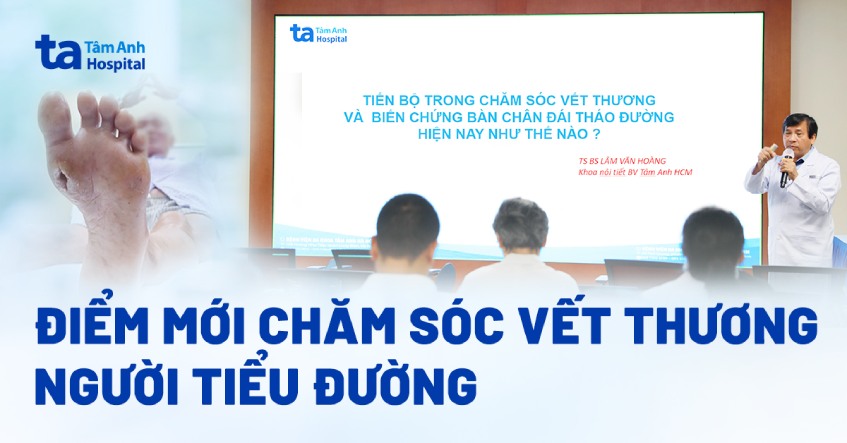 Điểm mới trong chăm sóc vết thương ở người tiểu đường hiệu quả