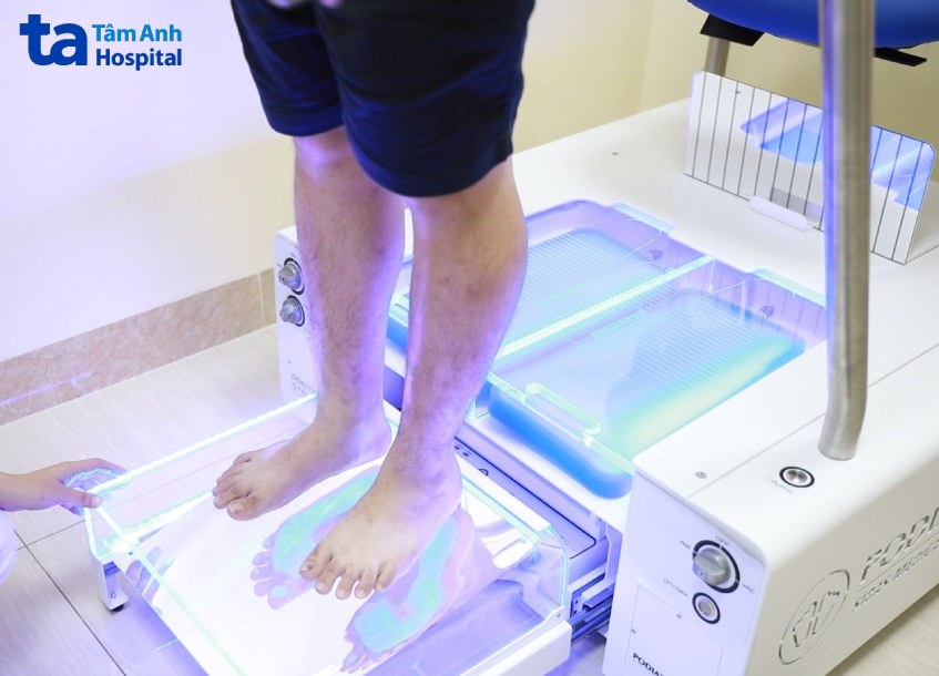 Đo áp lực bàn chân ở người tiểu đường