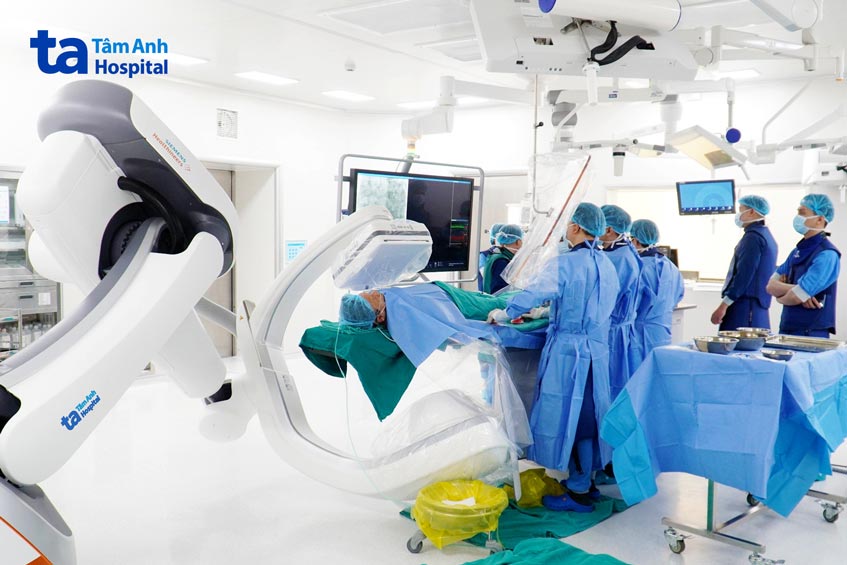 Bác sĩ Long (ngoài cùng) và ê kíp đặt stent cho người bệnh đột quỵ tim do chơi thể thao