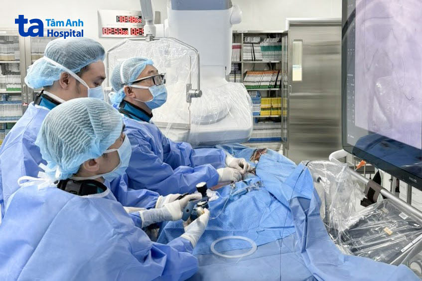 Ê kíp tiến hành đặt stent cứu các nhánh mạch vành tắc hẹp nặng cho bệnh nhân
