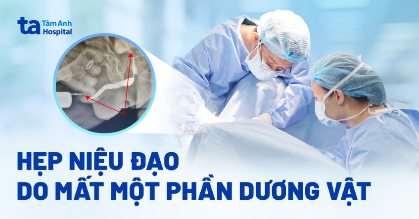 Hẹp niệu đạo do mất một phần dương vật