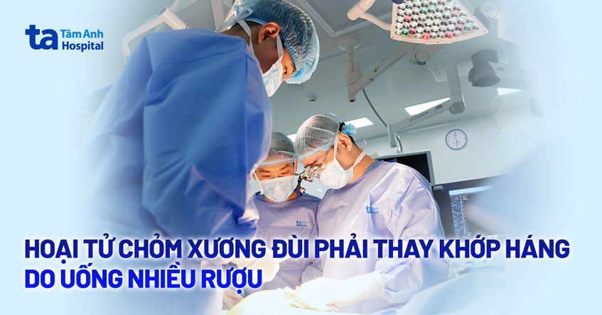 Hoại tử chỏm xương đùi phải thay khớp háng do uống nhiều rượu