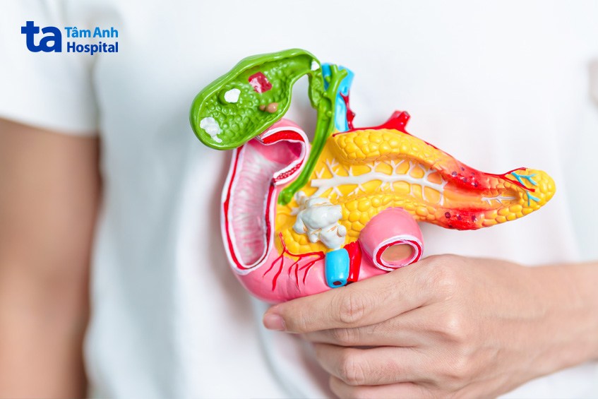 hội chứng vàng da tắc mật