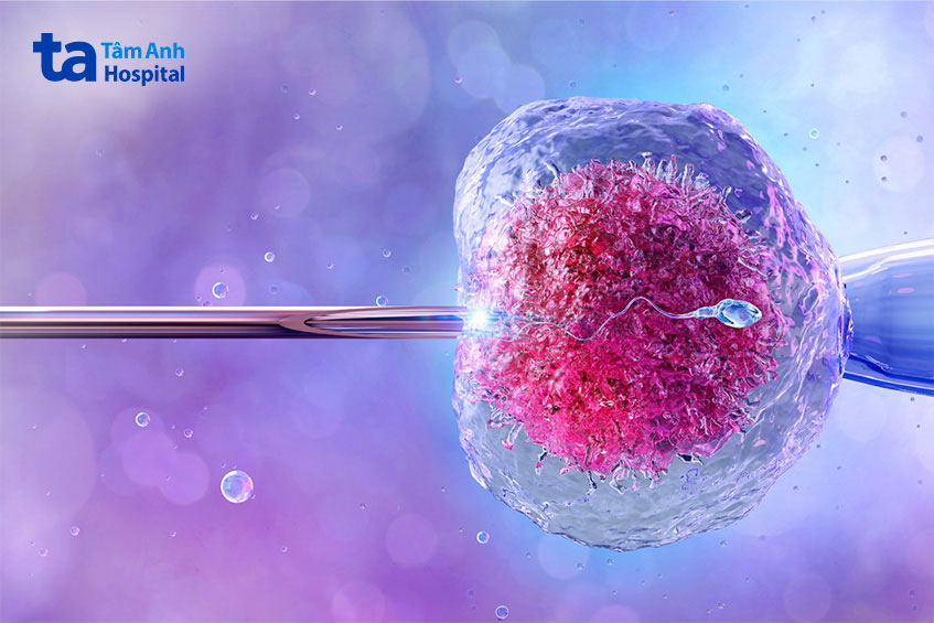 IVF có thể được chỉ định đối với bệnh nhân mắc hội chứng thiểu năng tinh trùng