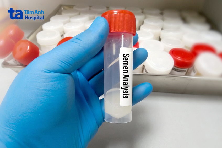 khi nào nam giới cần xét nghiệm tinh dịch đồ