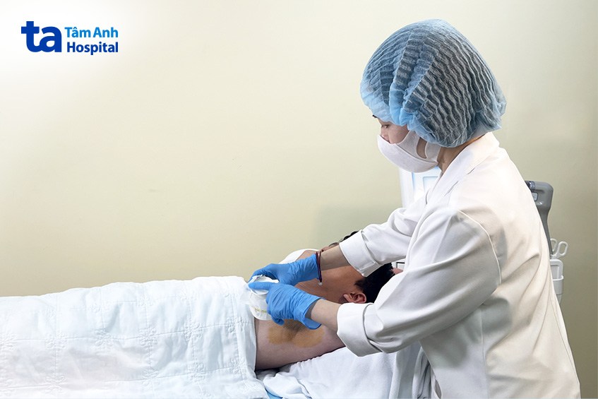 kiểm tra mức độ tăng tiết mồ hôi nách