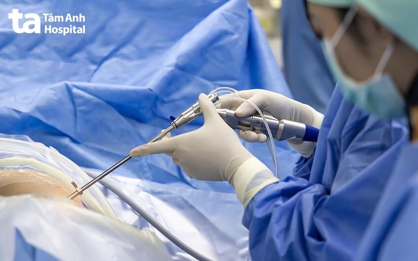 lựa chọn mổ khối u cột sống tại bvdk tâm anh