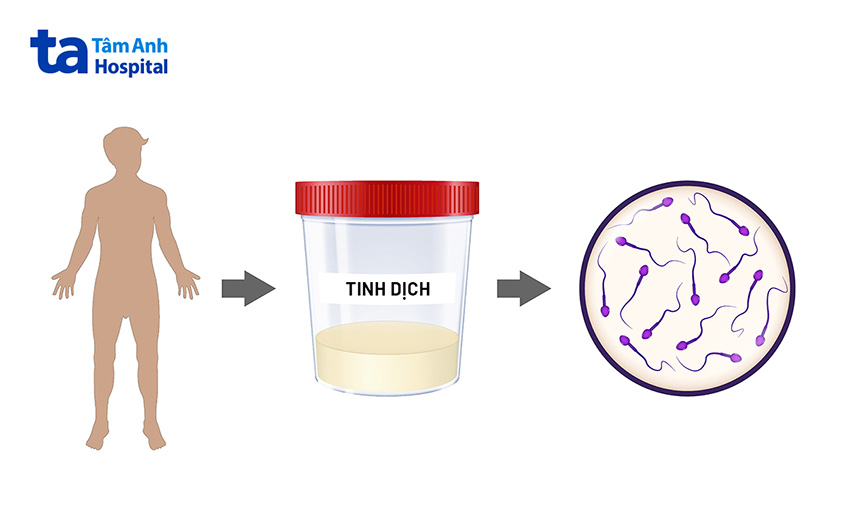 Mô phỏng quá trình lấy mẫu xét nghiệm tinh dịch đồ