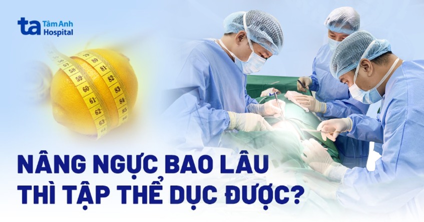 nâng ngực bao lâu thì tập thể dục được
