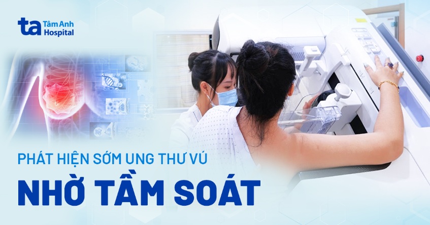 Nhiều chị em phát hiện sớm ung thư vú nhờ tầm soát