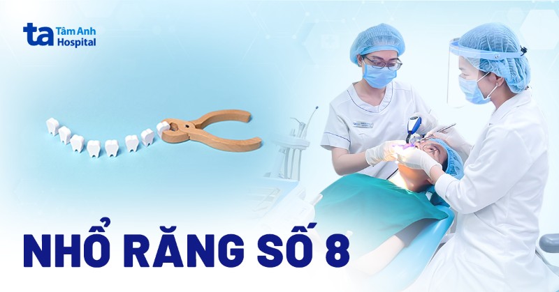 Nhổ răng số 8: Quy trình và các lưu ý trước, sau thực hiện