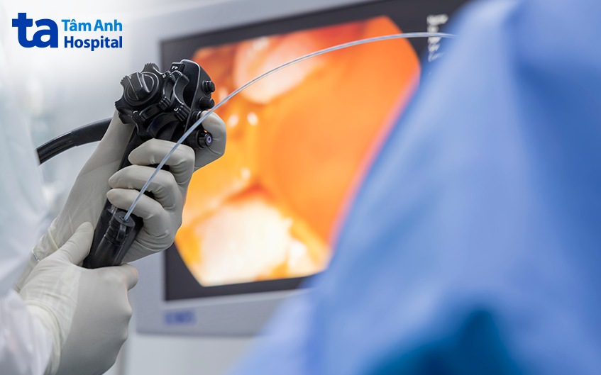 nội soi lấy sỏi ống mật chủ ERCP