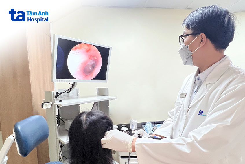 Thạc sĩ bác sĩ CKI Diệp Phúc Anh đang nội soi tai cho một người bệnh. Ảnh: Bệnh viện Đa khoa Tâm Anh.