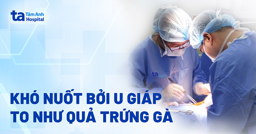 Nuốt khó vì khối u giáp to như quả trứng gà
