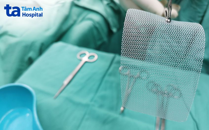 phẫu thuật điều trị thoát vị hoành