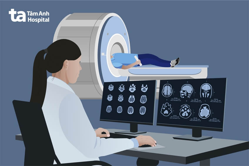 phương pháp chẩn đoán ung thư bằng mri