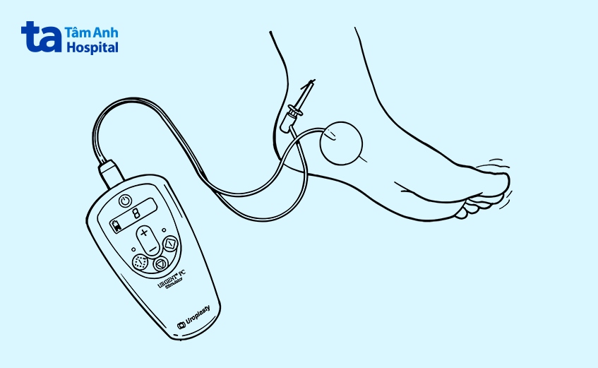 quy rình thực hiện