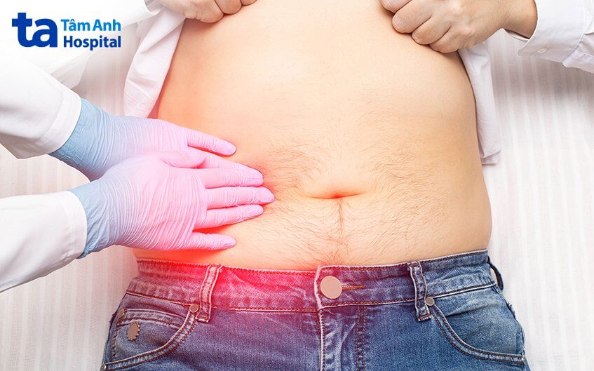 quy trình cắt dạ dày hình ống