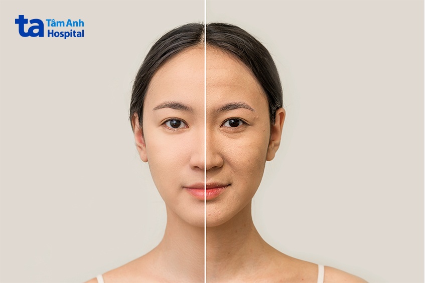 tác dụng của peel da mặt