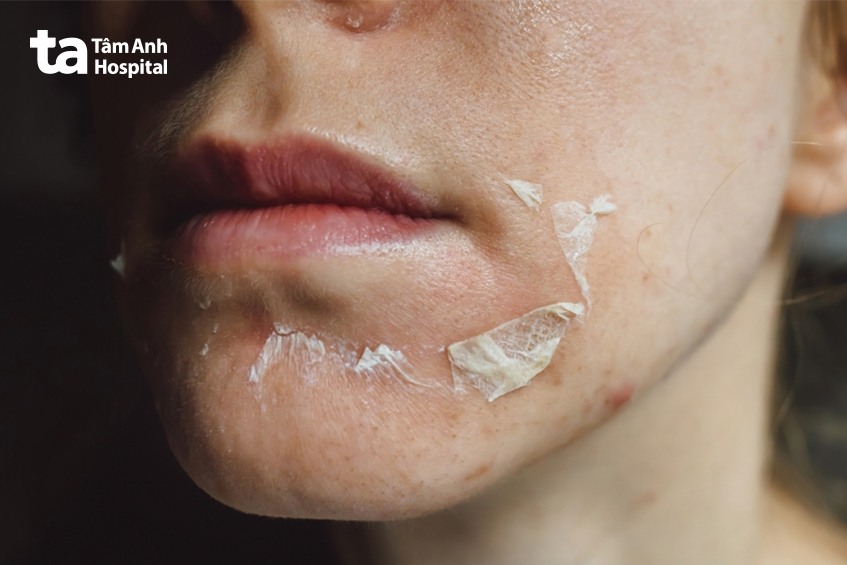 tca có tác dụng gì