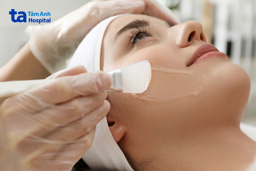 tca được sử dụng như thế nào