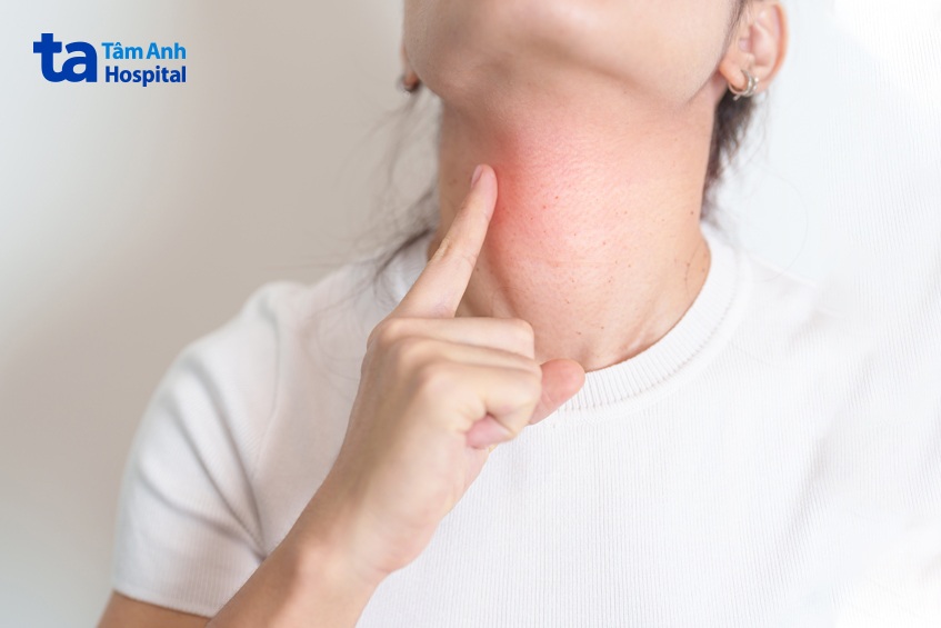 Triệu chứng u nang giáp móng