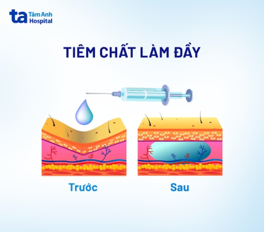 trước và sau khi tiêm