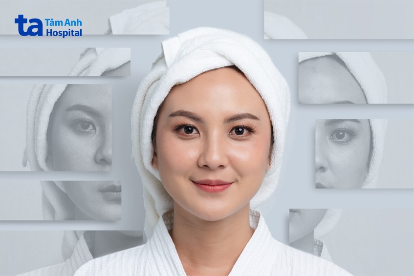 ưu điểm của tca