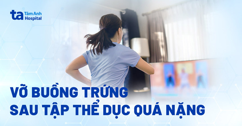 Cô gái nhập viện do vỡ nang buồng trứng sau tập thể dục nặng