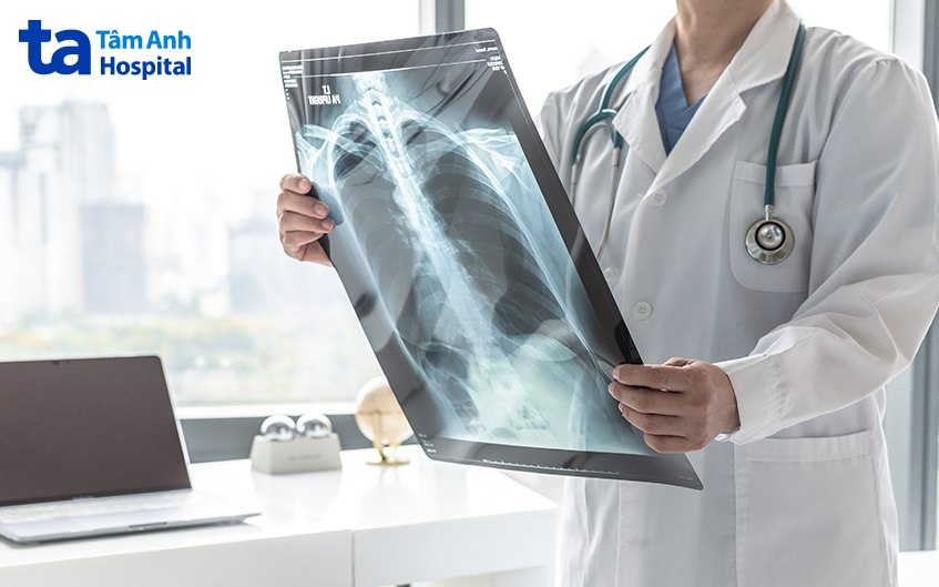 x quang phổi copd