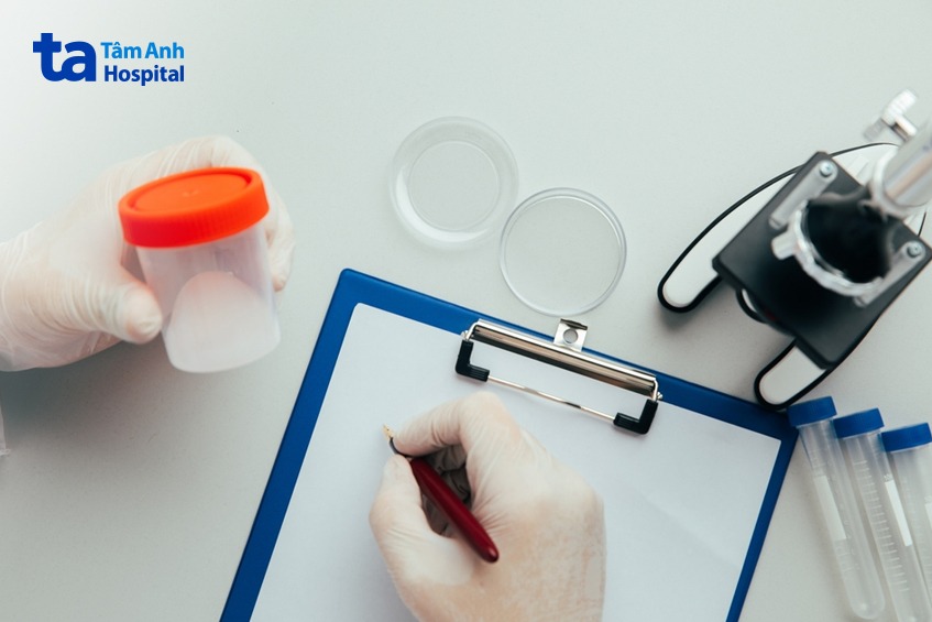xét nghiệm tinh dịch đồ khi nào trả kết quả