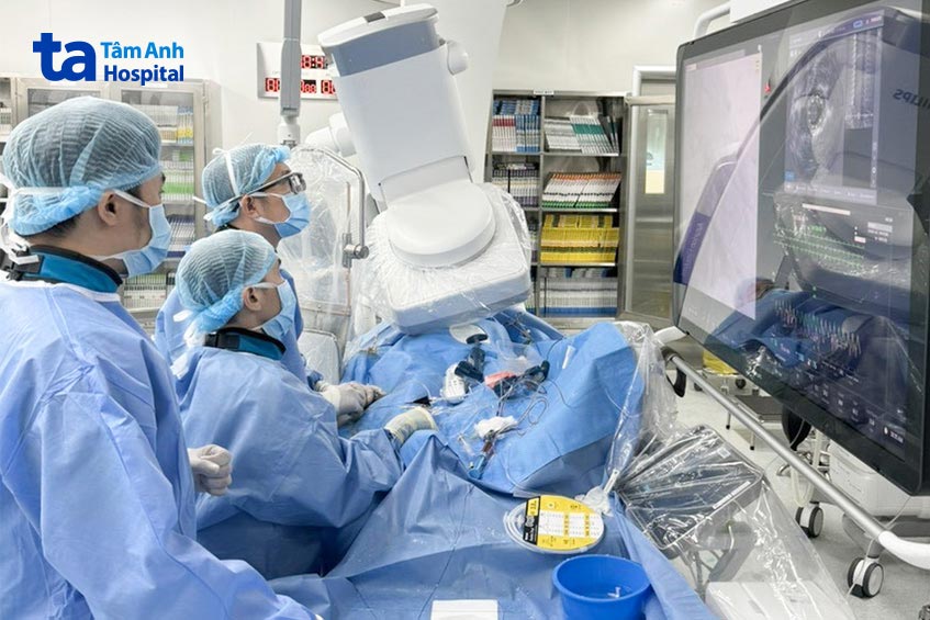 Bác sĩ Minh (ngoài cùng bên phải) cùng ê kíp can thiệp giải quyết tình trạng hẹp nghẽn mạch vành phức tạp cho bệnh nhân