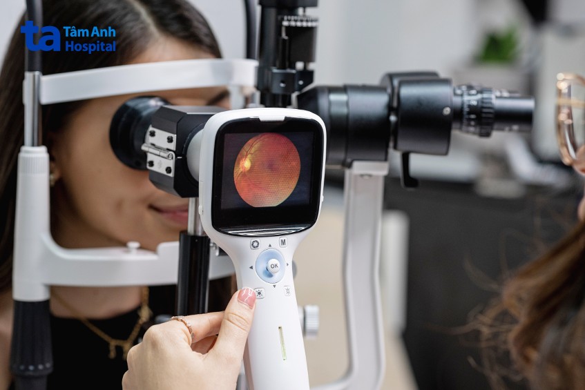 bác sĩ sử dụng kính soi đáy mắt trực tiếp