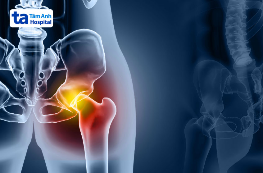 bệnh khiến khớp bị bất động