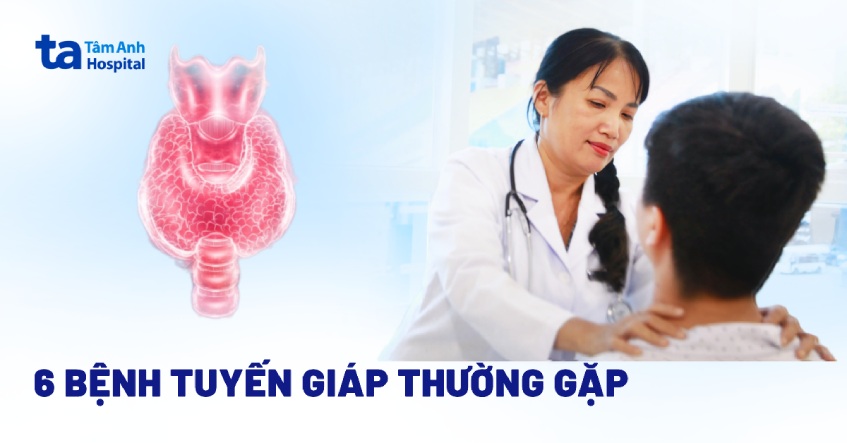 6 bệnh tuyến giáp ở nam thường gặp: Dấu hiệu, nguyên nhân