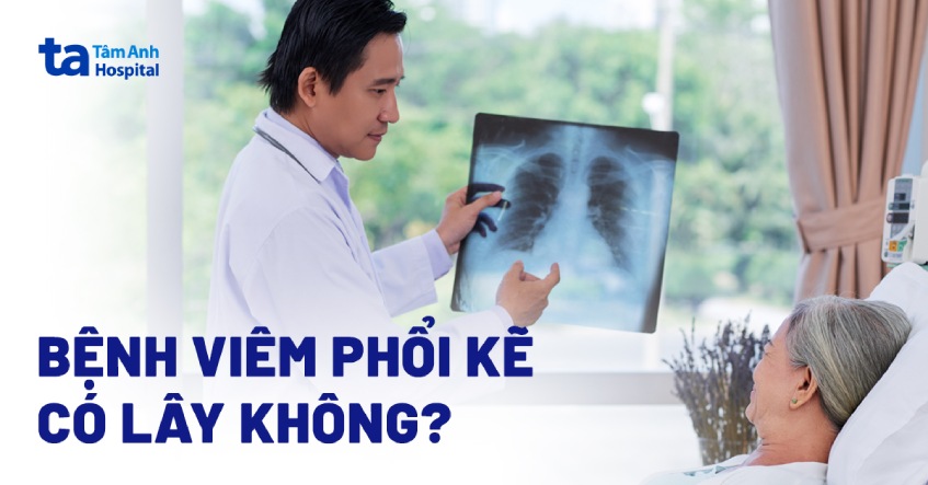 Bệnh viêm phổi kẽ có lây không? Đối tượng nào dễ mắc phải?