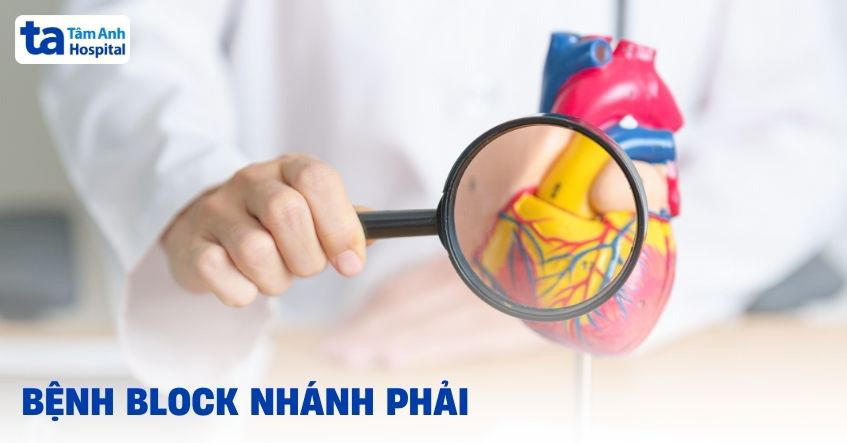 Block nhánh phải