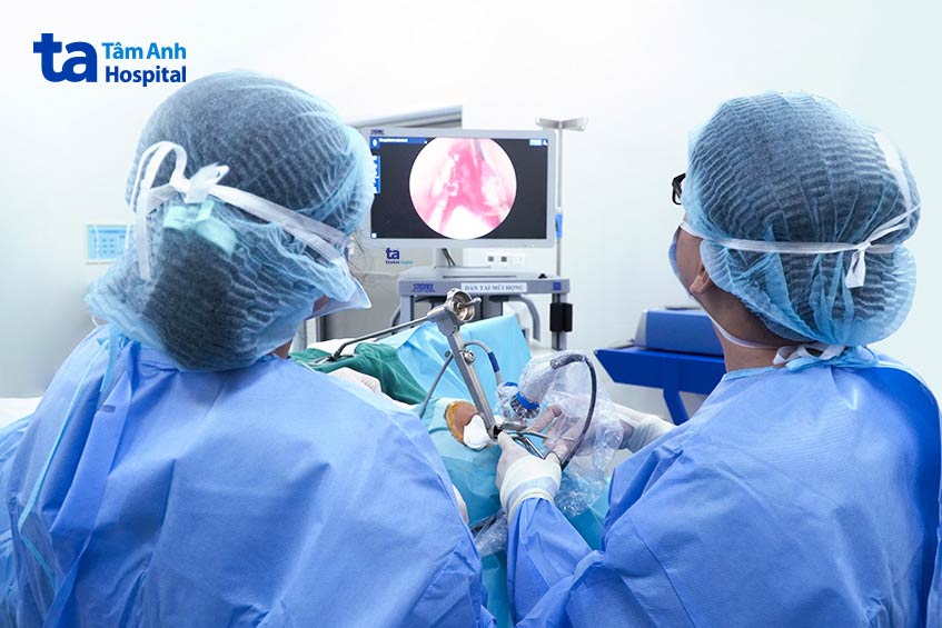 bs anh phẫu thuật nội soi vi phẫu polyp thanh quản