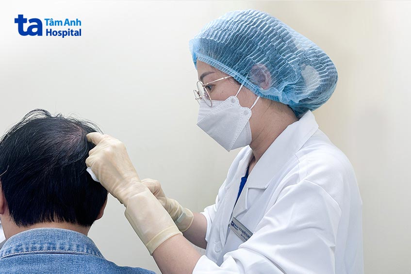 bs dung tiêm vi điểm thuốc kích thích mọc tóc