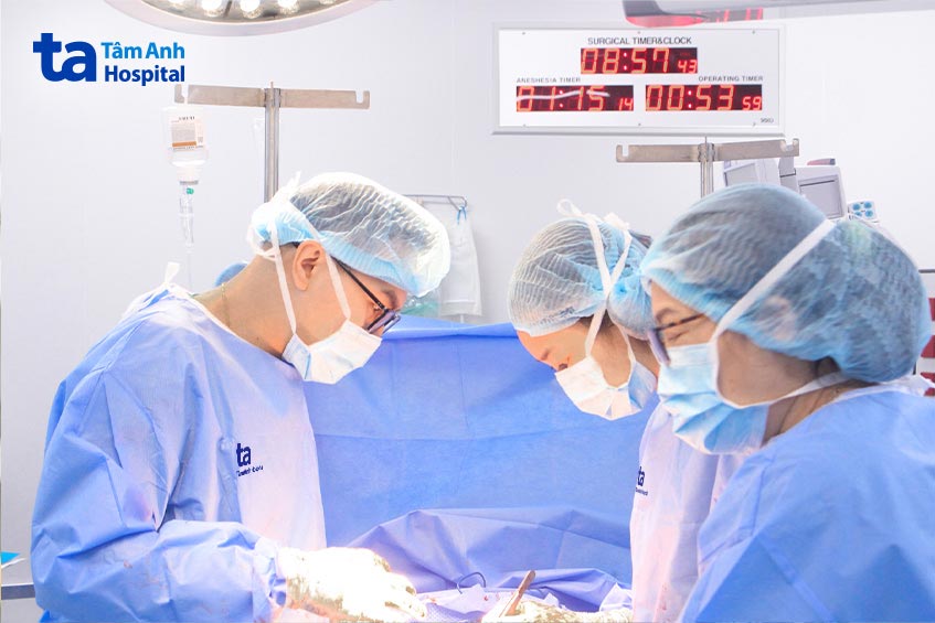 Bs duy phẫu thuật bóc u xơ