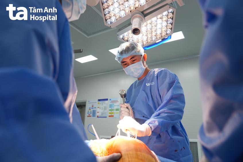 bs lưu thay khớp gối cho người bệnh