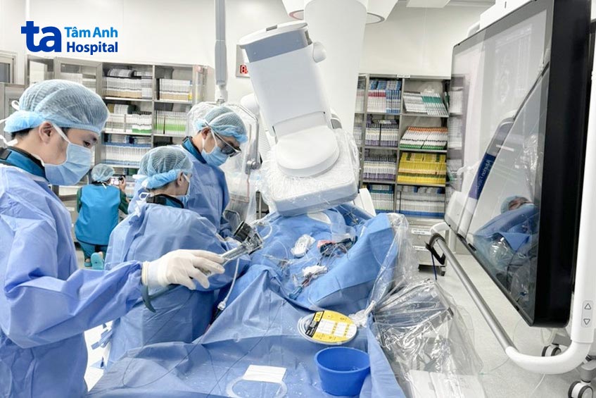 Các bác sĩ chuẩn bị dụng cụ cho một ca can thiệp đặt stent tái thông mạch vành