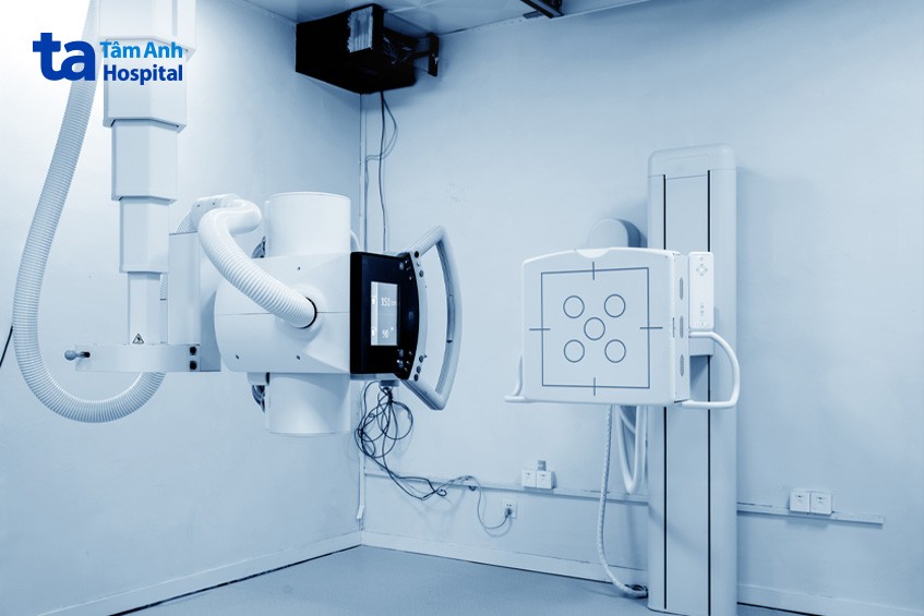 các loại máy chụp x quang