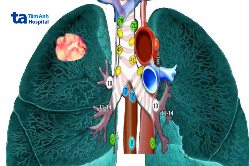 các nhóm hạch trung thất