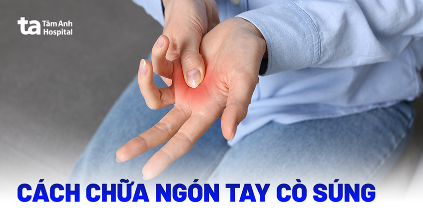 3 cách chữa ngón tay cò súng được chuyên gia chỉ định hiện nay