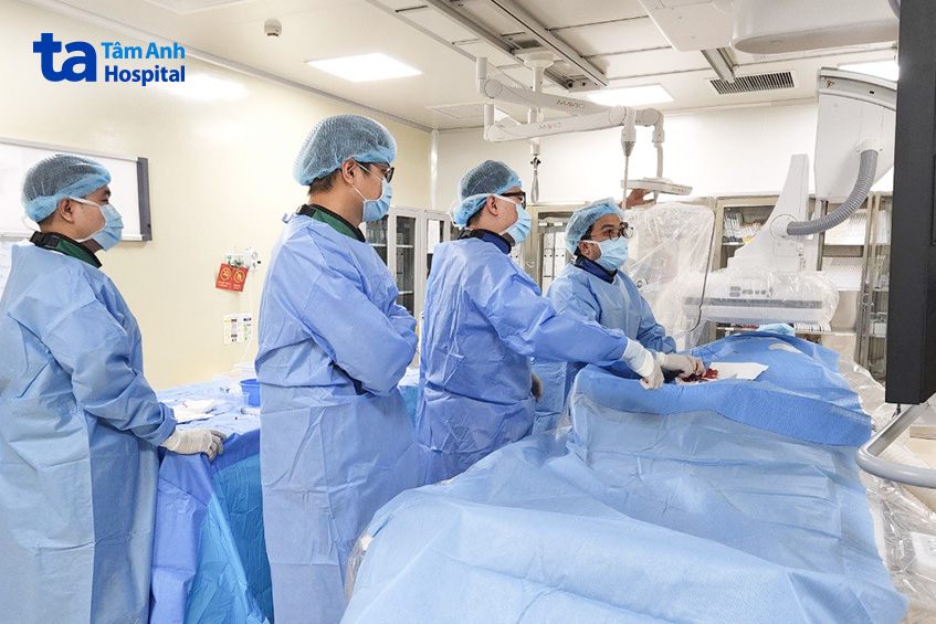 can thiệp điều trị tắc nghẽn mạch máu não tại bvđk tâm anh