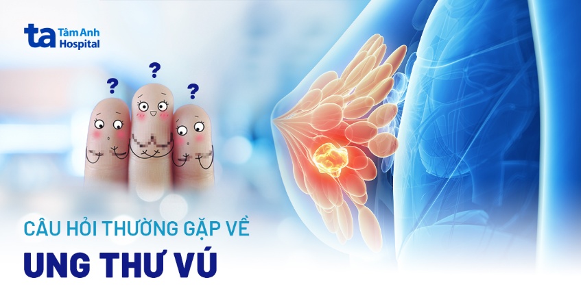 Các câu hỏi về ung thư vú nên hỏi bác sĩ khi chẩn đoán và điều trị